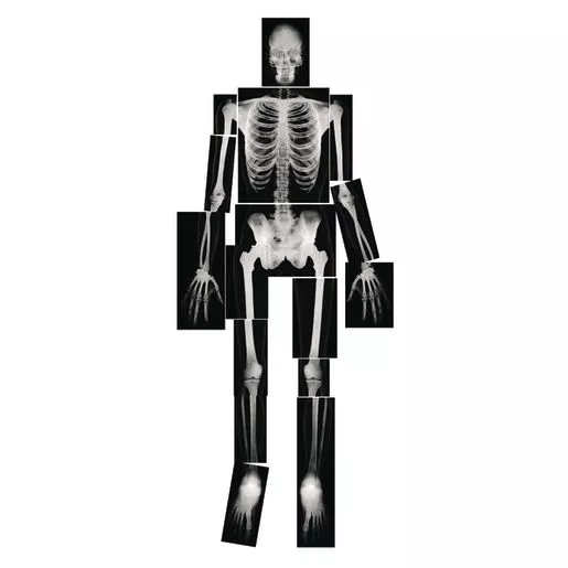 Human X-Rays - Set of 18